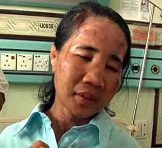 Siti, 3 Tahun Disiksa Majikan