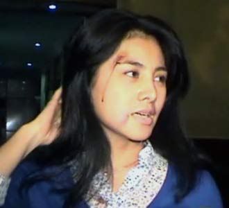 Cici Paramida Babak Belur