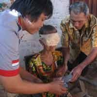 Bantuan Pembaca untuk Wajah Berlubang Diserahkan