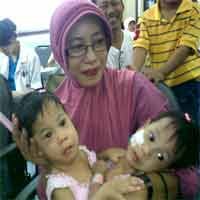 Janeeta-Janeetra Jalani Operasi Pemisahan Juli