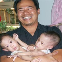 Usia Kembar Janeeta-Janeetra Genap 1 Tahun