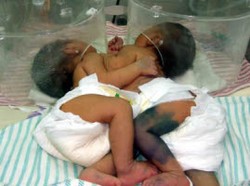 Gubernur Sumsel Berharap Rafa-Rafi Dapat Diselamatkan