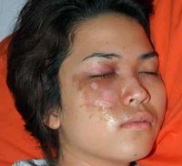 Menjenguk Dinda Kanya Dewi