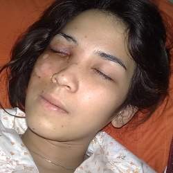 Pasca Kecelakaan, Dinda Kanya Dewi Terbang ke Singapura