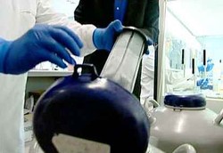 Sperma Bisa Dibuat di Laboratorium