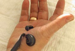 Terapi Lintah Sembuhkan Penyakit Berat