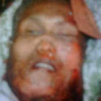  Foto Kepala Diduga Pelaku Bom Bunuh Diri di Marriott Beredar 