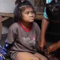 Psikiater: Ningsih Mengalami Kelainan Retardasi Mental