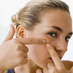 Tak Mau Berjerawat? Ini Tipsnya!