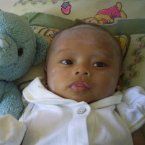 Fildzah Nafisah, 5 Bulan; Perempuan; f