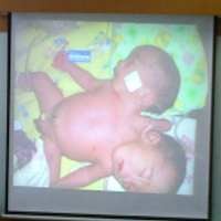 Kasus Langka dan Pertama di Indonesia