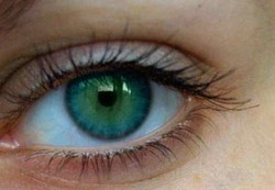 Gadis Cilik Jerman Melihat Sempurna Lewat Satu Mata 