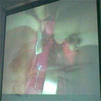 Hari ke-4, Bayi Janeeta Minum Tanpa Infus