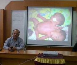 Ambulans Pembawa Jenazah Bayi Berkepala Dua Mogok di Pelalawan