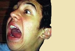 Penderita Sindrome Tourette yang Tak Pernah Tenang