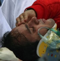 Mata Massa Tak Apa-apa