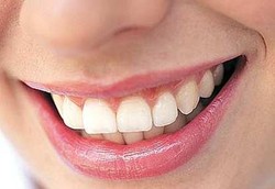 Reparasi Gigi dengan Implan