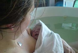 Plus Minus Persalinan Dalam Air