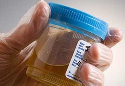 Terapi Urine Hilangkan Penyakit?