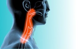 Dysphagia