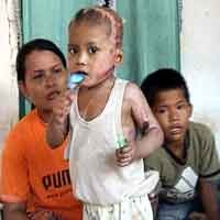 Dirawat 58 Hari, Fery Bisa Bermain Lagi