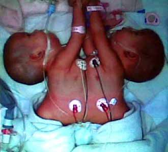 Rosida-Rosita Jalani Operasi 13 Agustus