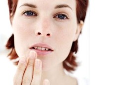 Mengatasi Bibir Pecah-pecah