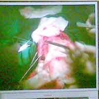 Rosita-Rosida Berhasil Dipisahkan