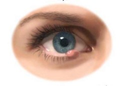 Mata Bintit Bukan Karena Ngintip 