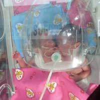 Kembar Siam Madiun Dirujuk ke RSU Soetomo