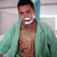 Polisi Malaysia Disiram Air Keras oleh Mantan Istri