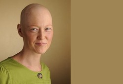 Tak Ada Kata Menyerah Melawan Kanker Payudara