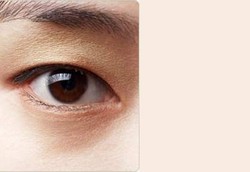 Katarak si Pencuri Penglihatan