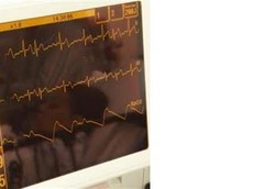 Amlodipin untuk Gangguan Kardiovaskular