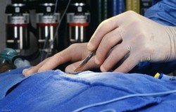 Alpha-1 Antitrypsin Deficiency (A1AD)