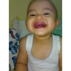 Rr. Zaskia Cahya Ramadhany, 1 Tahun; Perempuan; f