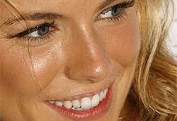 Warna Gigi dan Artinya