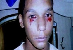 Misteri Nangis Darah Calvino Inman