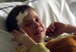 6 Kondisi Cedera Kepala Anak yang Tak Perlu CT Scan