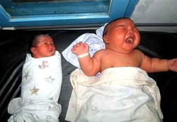 Bayi Raksasa 8,7 Kg Lahir di Sumut, Rekor Baru di Indonesia