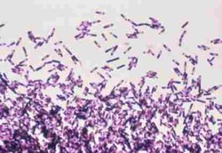 Bakteri di Usus Berevolusi Menjadi Lebih Ganas