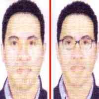 Anus Noordin Rusak Bukan Akibat Kecelakaan atau Penyakit Bawaan 