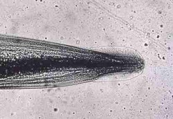 Cacing Usus Melindungi Tubuh dari Alergi dan Asma