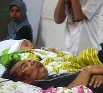 Korban Luka Gempa Sumbar