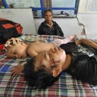 Operasi Bedah Tulang Mulai Dilakukan Hari Ini