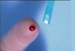 Bahaya Tekanan Gula Darah yang Kelewat Rendah