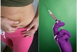 10 Operasi Kosmetik yang Sebaiknya Dihindari