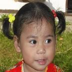 Nayla Septya Rheznandya, 1,5 Tahun; Perempuan; f