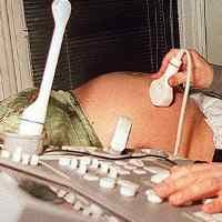 Koma 22 Minggu, Seorang Wanita Jerman Lahirkan Bayi Normal