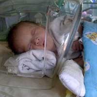 Bayi Tanpa Dinding Perut Lahir di Madiun 